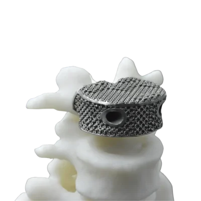 3D Printed Cage from Titanium Alloy Powder