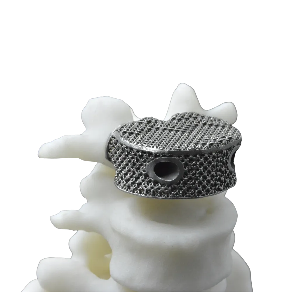 3D Printed Cage from Titanium Alloy Powder