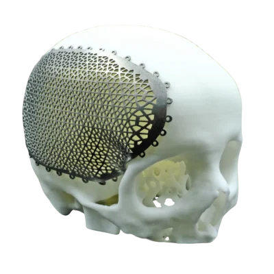 3D Printed Medical Part Titanium Alloy Powder