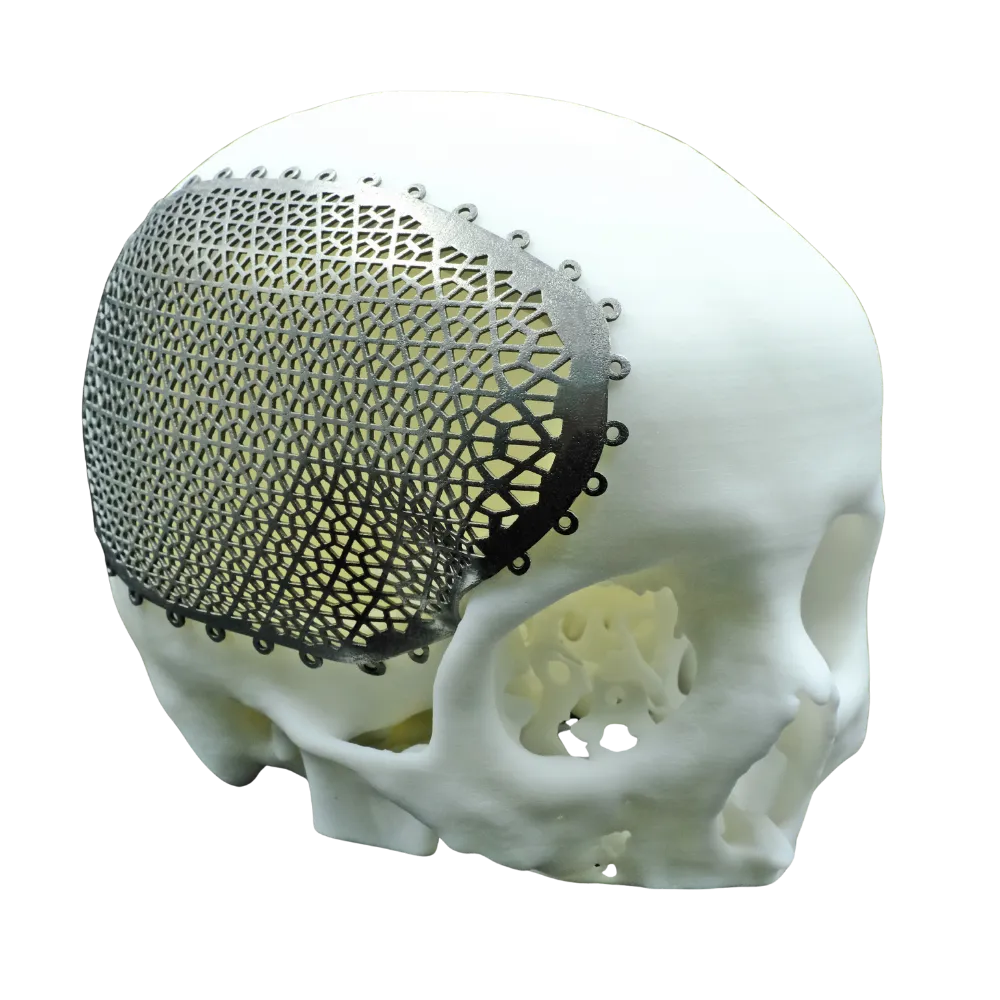 3D Printed Medical Part Titanium Alloy Powder