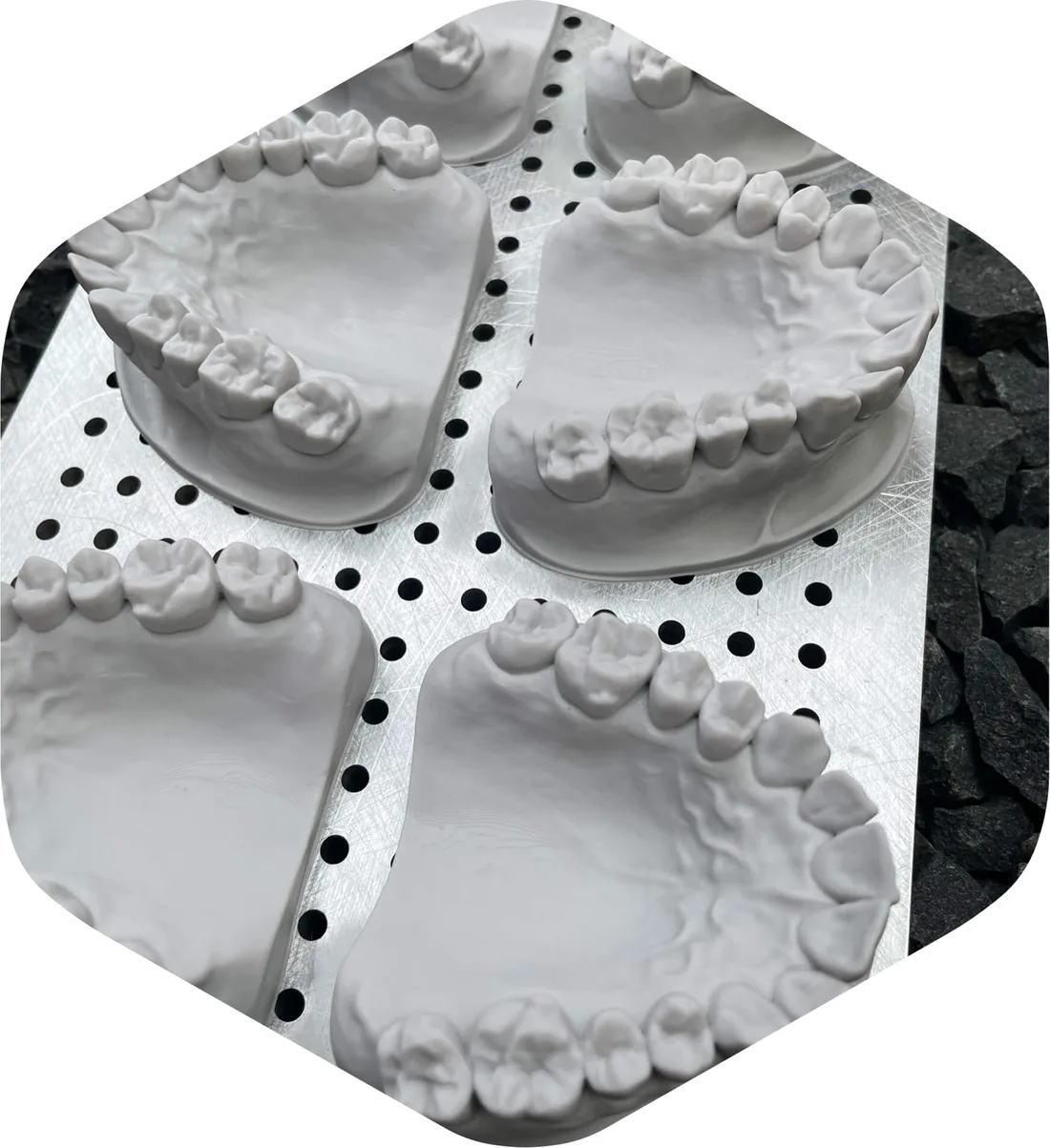 Dental models printed on the Axtra3D Lumia X1 with a validated resin