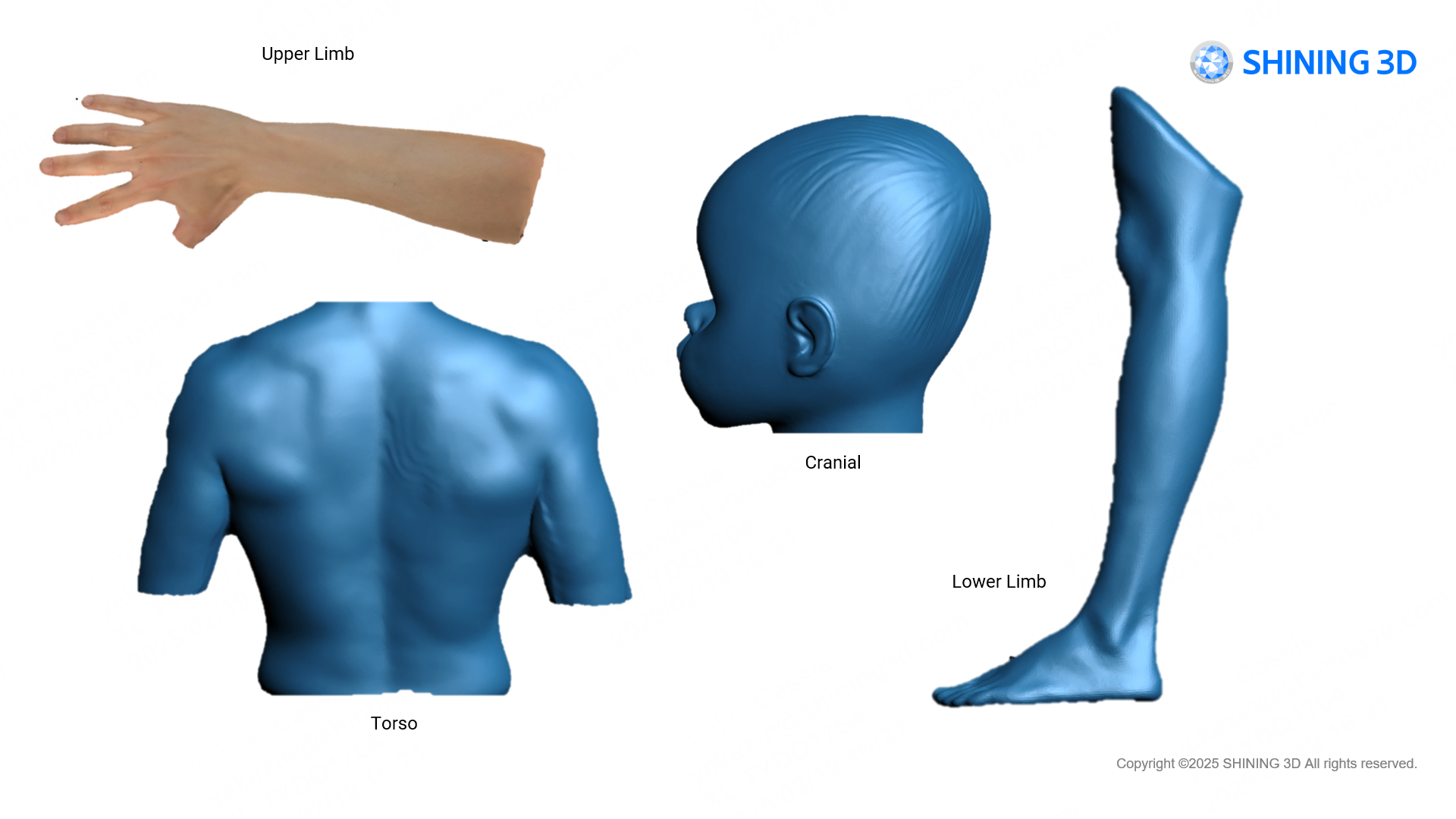 Shining 3D EXScan O&P Software – Orthotics & Prosthetics Scan-to-Design | For EinScan H2
