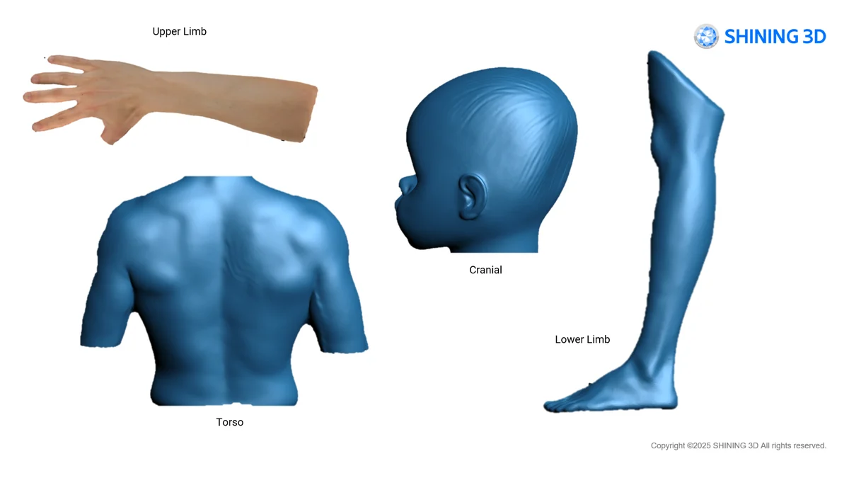 Shining 3D EXScan O&P Software – Orthotics & Prosthetics Scan-to-Design | For EinScan H2